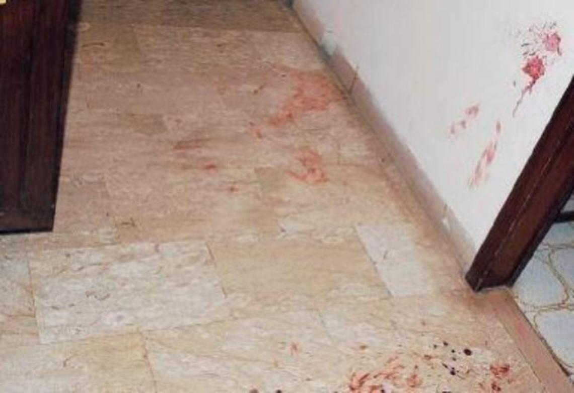 Aggredì con un martello 2 pensionati, ecco cosa ha deciso il giudice