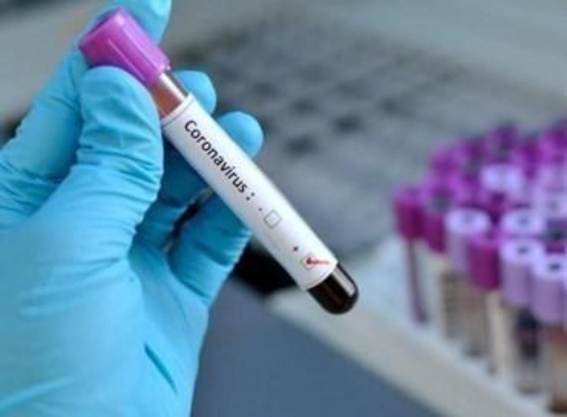 Coronavirus, positivo titolare di uno stabilimento balneare: chiuso il lido