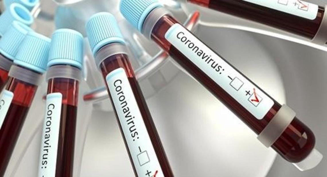 Covid, comunità ancora in allerta: record di nuovi positivi