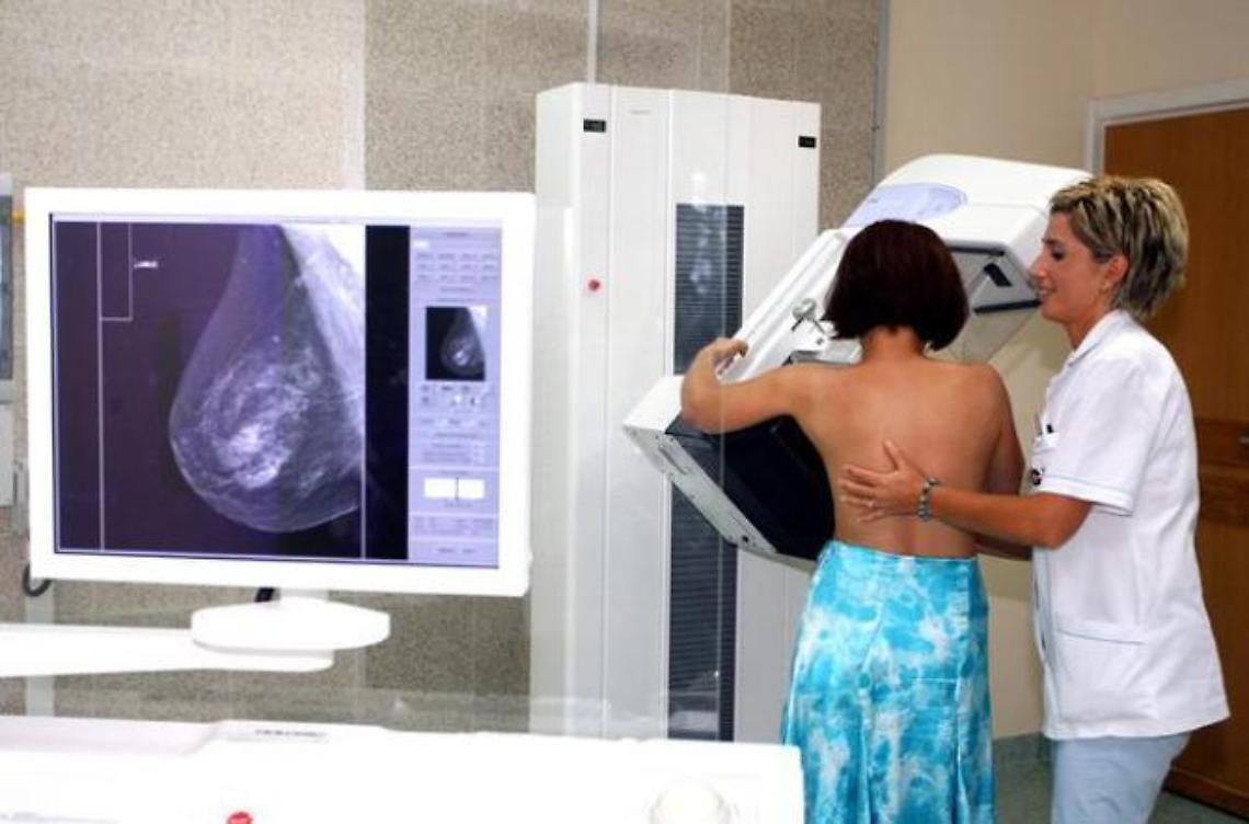 Frosinone: record di mammografie effettuate. Ma tempi d'attesa ancora lunghi