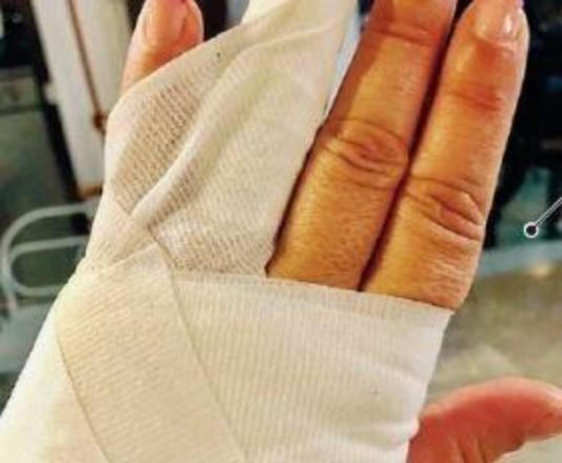 Urtata da un'auto che non si ferma: ciclista lancia un appello sui social