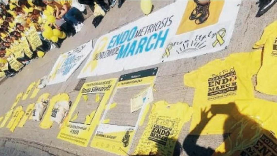 "Endopank": nasce la panchina simbolo della lotta contro l'endometriosi