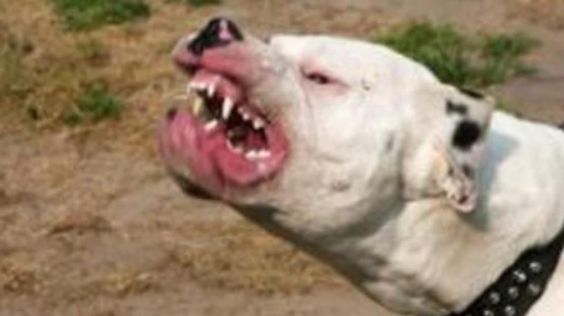 Bambina azzannata da un pitbull. Il cane forse fuggito da un giardino