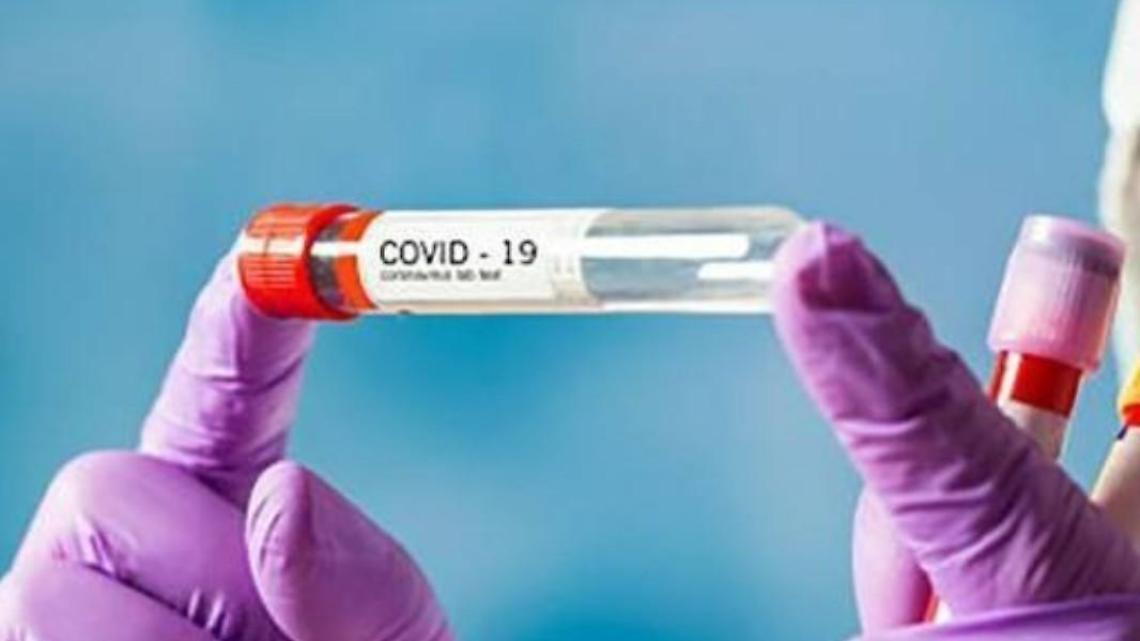 Covid Ciociaria, meno contagi e ricoveri. In un giorno oltre mille guariti