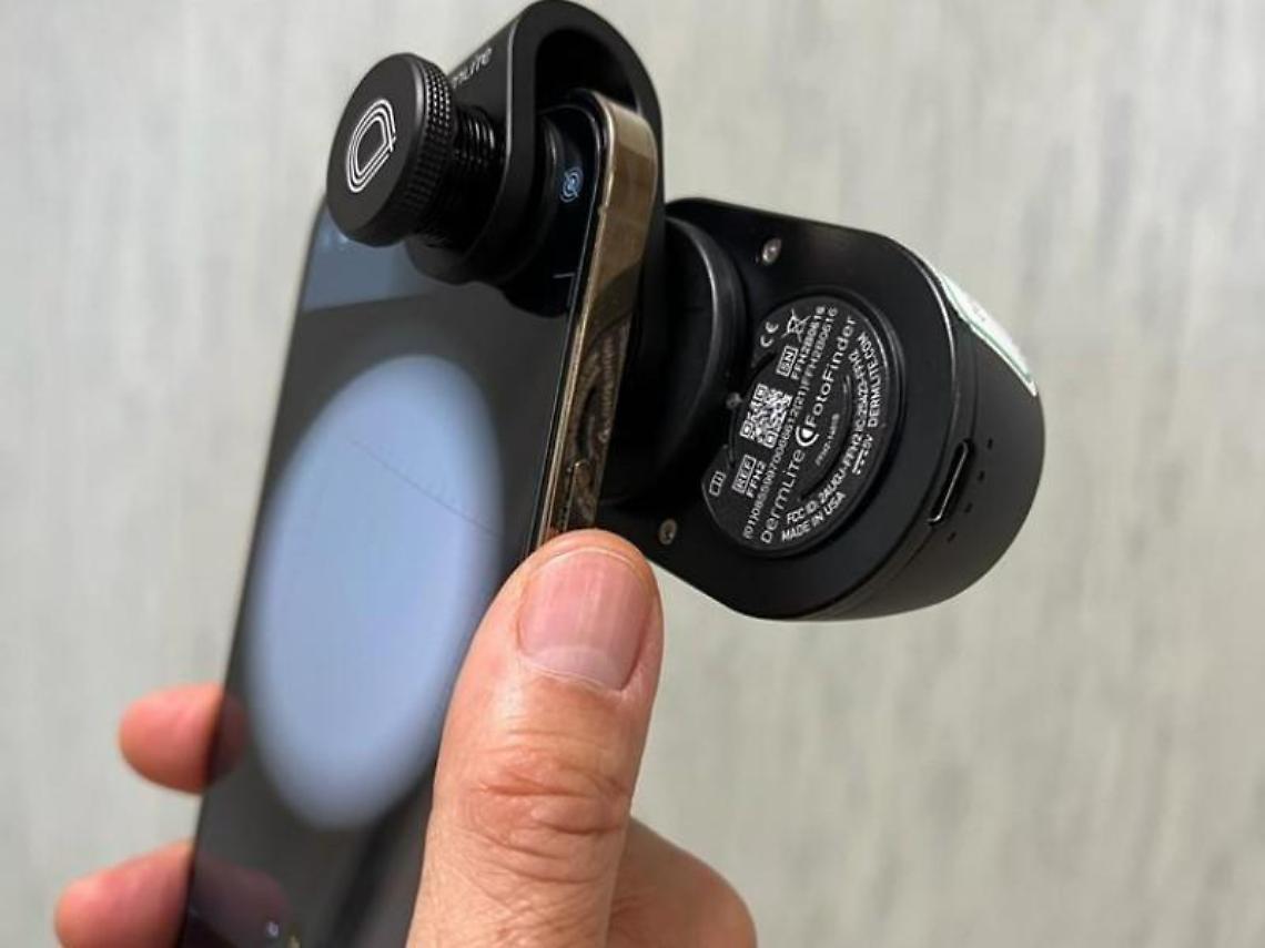 Tumori della pelle. La teledermatologia arma di prevenzione