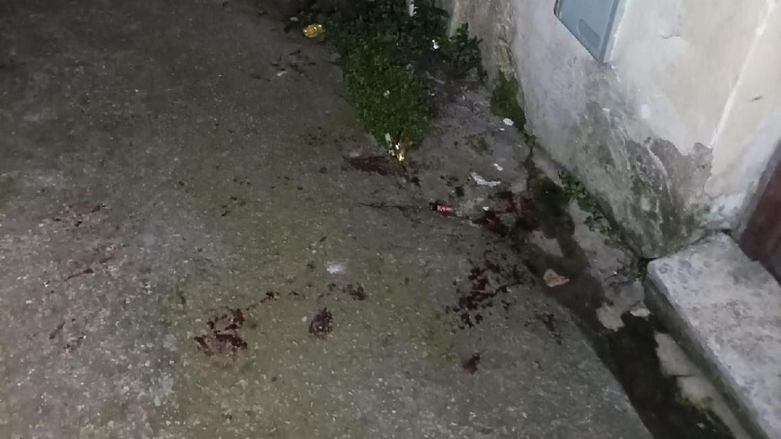 Donna accoltellata. Il racconto dei momenti precedenti alla violenza