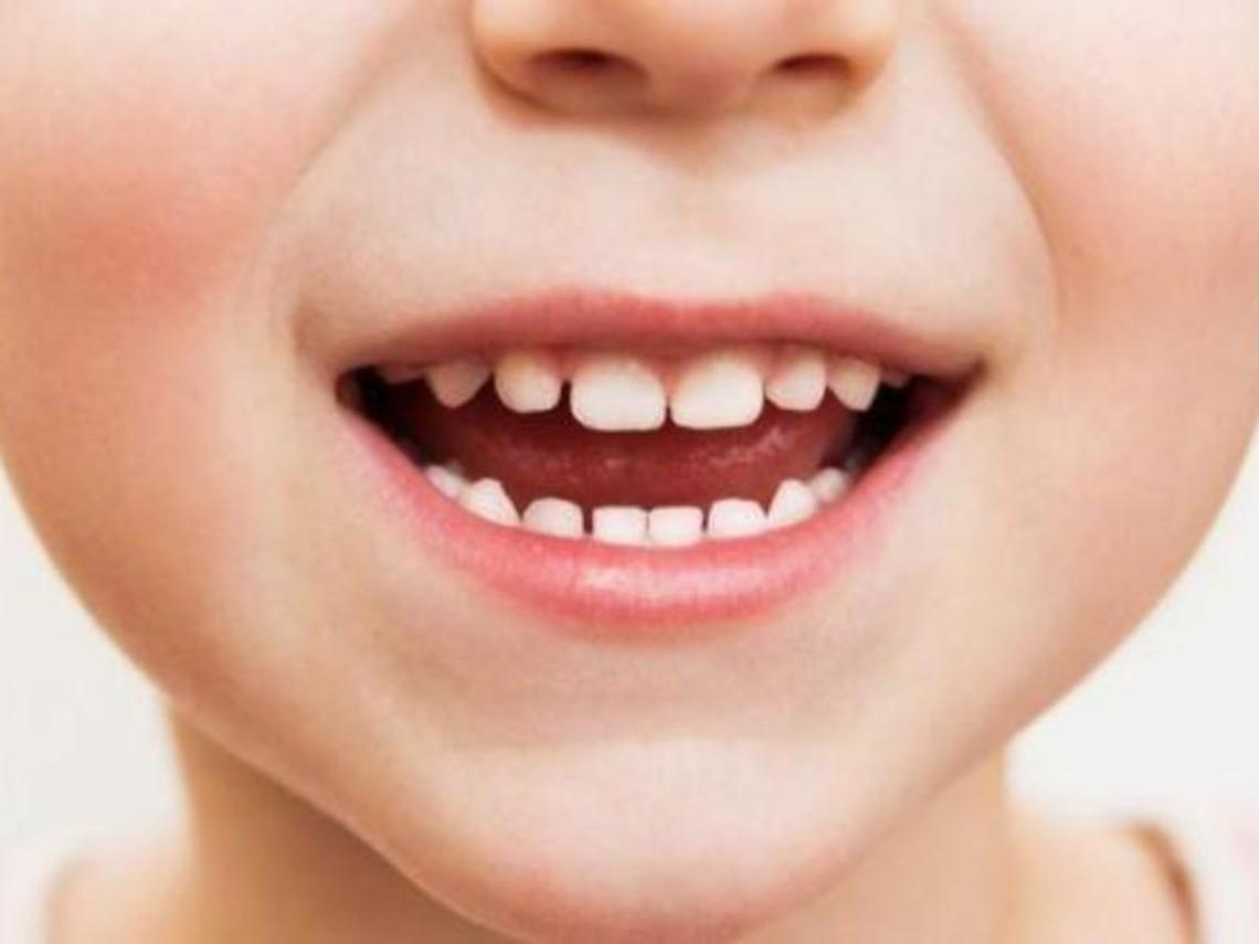 Col 'safety day' vince la prevenzione: una giornata per i più piccoli