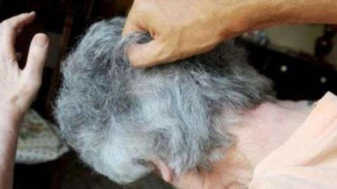 Riempie di botte l'anziana madre che fugge di casa tutta insanguinata: l'epilogo
