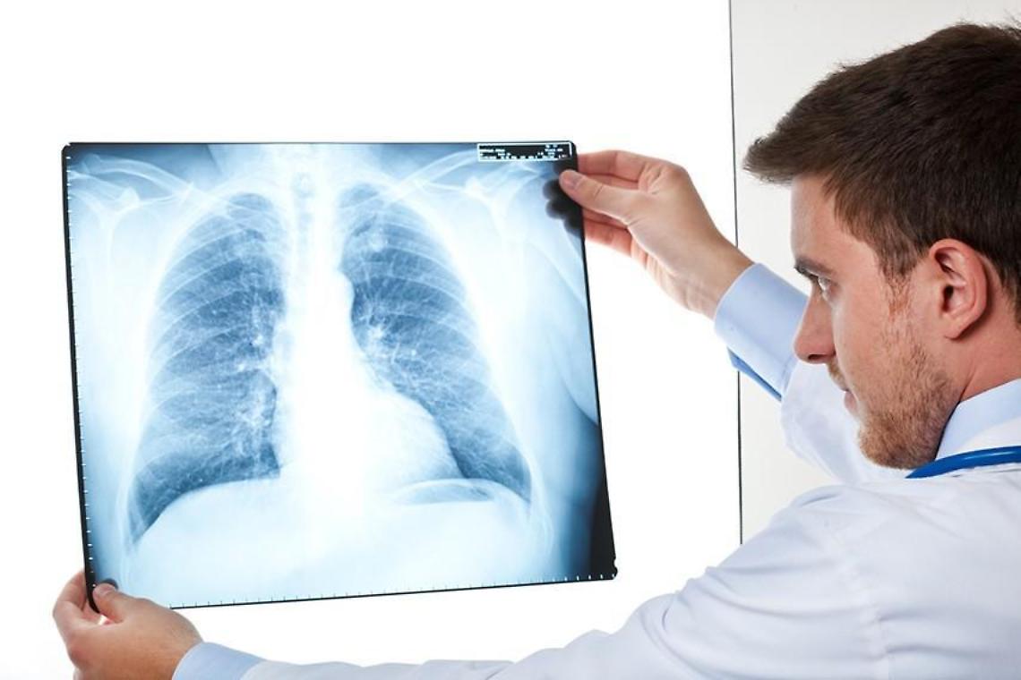 Ceprano, Casa della salute: il servizio di radiologia è pronto a partire