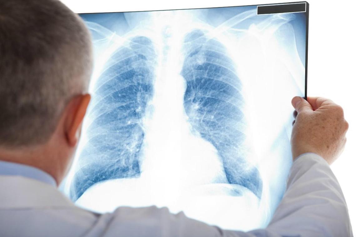 Alatri, lotta contro la fibrosi cistica: giornata di sensibilizzazione