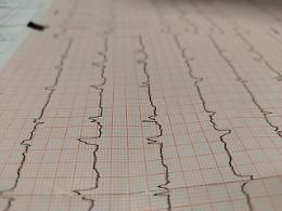 Elettrocardiogramma ed esame  holter anche in farmacia