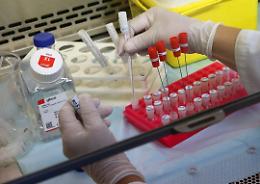 Da domani test sierologici gratuiti per i donatori di sangue