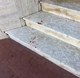 Sangue sulle scale del palazzo, residenti allarmati: vengono a drogarsi