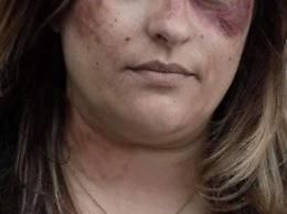 'No' alla violenza sulle donne, l'assessore in campo. Un commento indigna tutti