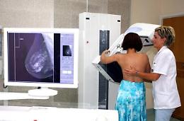 Frosinone: record di mammografie effettuate. Ma tempi d'attesa ancora lunghi