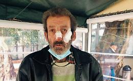 Fugge da un branco di cinghiali ma cade e si ferisce: la disavventura di Mario
