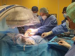 Sanità, interventi chirurgici d'avanguardia a Neurochirurgia