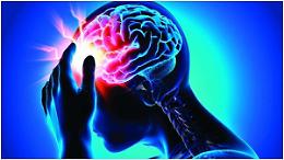 Ictus, determinante il fattore tempo. Come riconoscere i primi sintomi