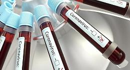 Coronavirus Cervaro, l'amministrazione fa il punto: "5 in totale i casi positivi"