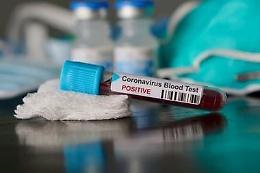 Emergenza Coronavirus, un uomo deceduto a Supino. L'annuncio del sindaco