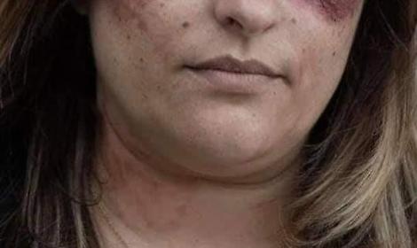 'No' alla violenza sulle donne, l'assessore in campo. Un commento indigna tutti