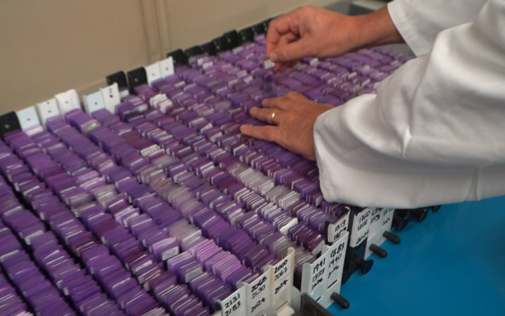 Una giornata dedicata all'emoglobinuria parossistica notturna