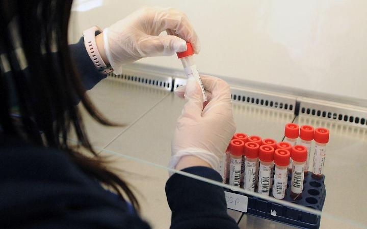 Covid, il 31 gennaio la variante Omicron nel 99,1% dei campioni